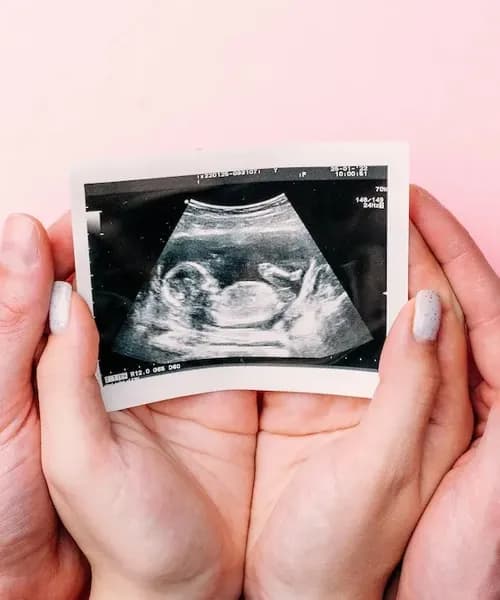 Anomaly Scan at Trichy Fetal Medicine and Fertility Centre