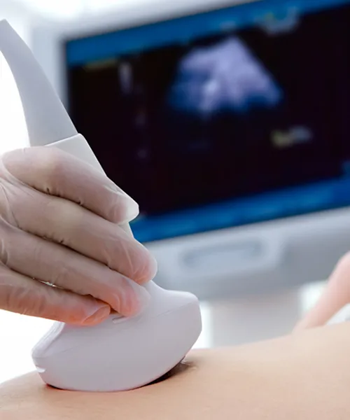 Fetal Neurosonogram at Trichy Fetal Medicine and Fertility Centre